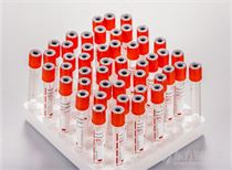 EMA批准Moderna新冠疫苗在欧盟有条件使用