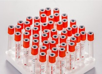 美卫生部长叫停数亿美元新冠疫苗协议